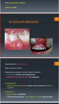 پاورپوینت Acquired Disturbances of the Teeth and Associated Oral Structures