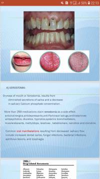 پاورپوینت انگلیسی دندانپزشکی اثرات داروها محوطه دهانی
